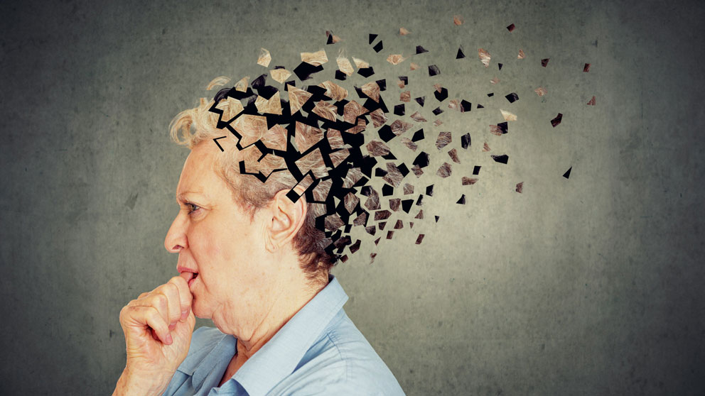 preventing alzheimer’s disease through lifestyle changes